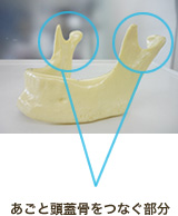 顎と頭蓋骨をつなぐ部分