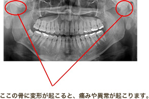 ここの骨に変形が起こると、痛みや異常が起こります。